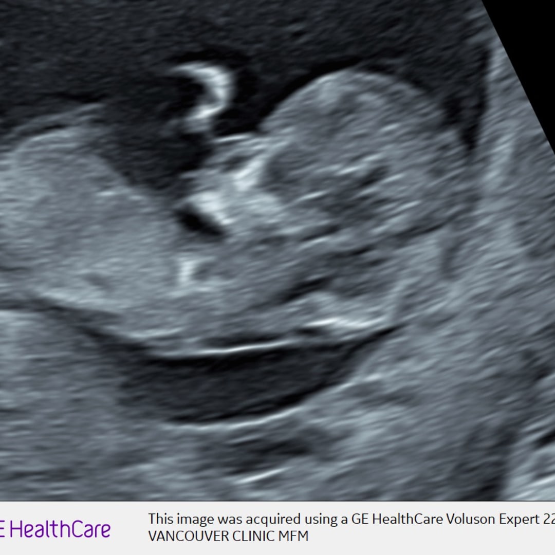 Photo shared by Emily for their Babylist baby registry.