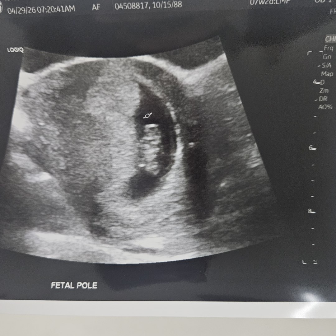 Photo shared by Brianna for their Babylist baby registry.