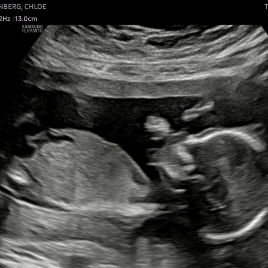 Photo shared by Chloe for their Babylist baby registry.
