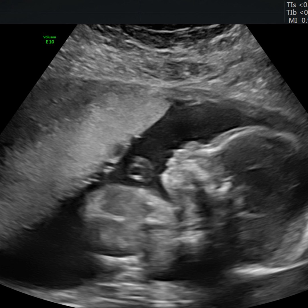 Photo shared by Christi for their Babylist baby registry.