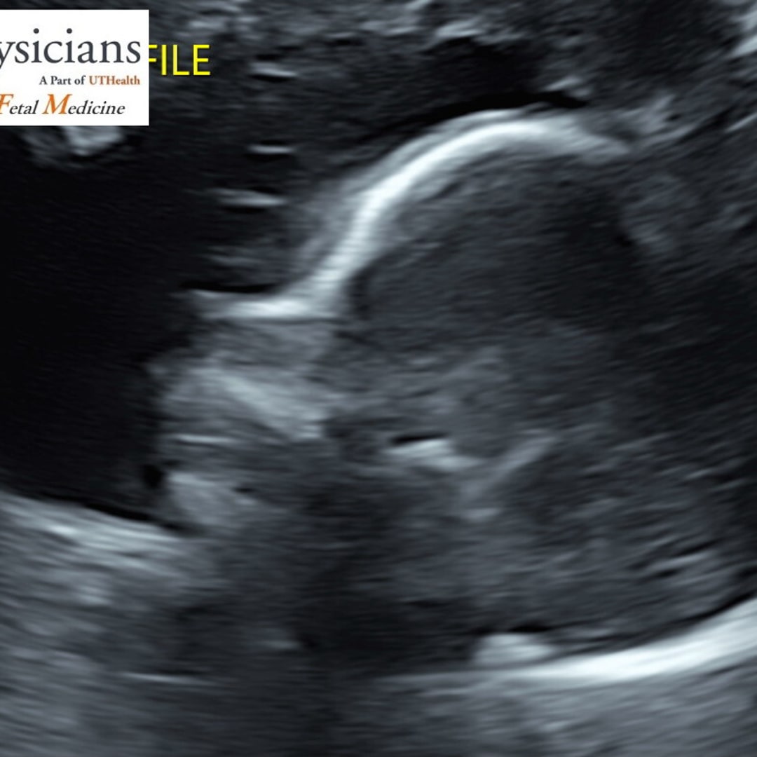 Photo shared by Ebony for their Babylist baby registry.