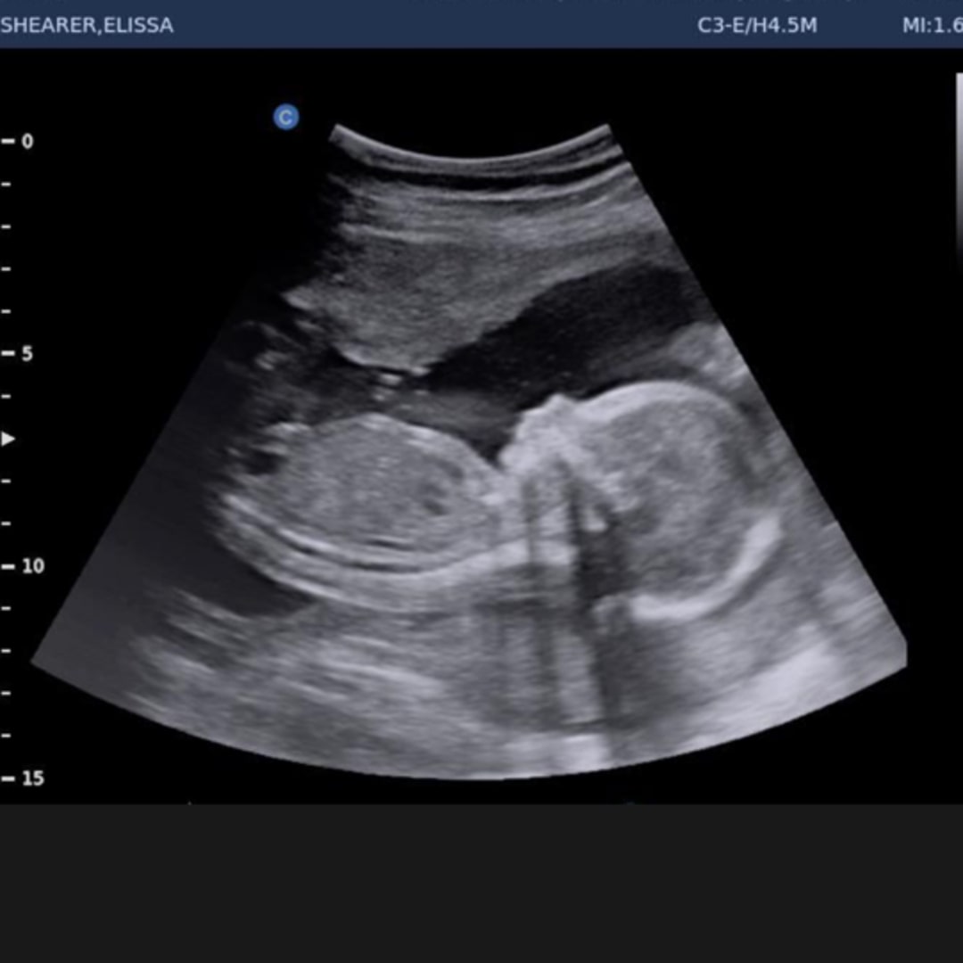 Photo shared by Elissa for their Babylist baby registry.