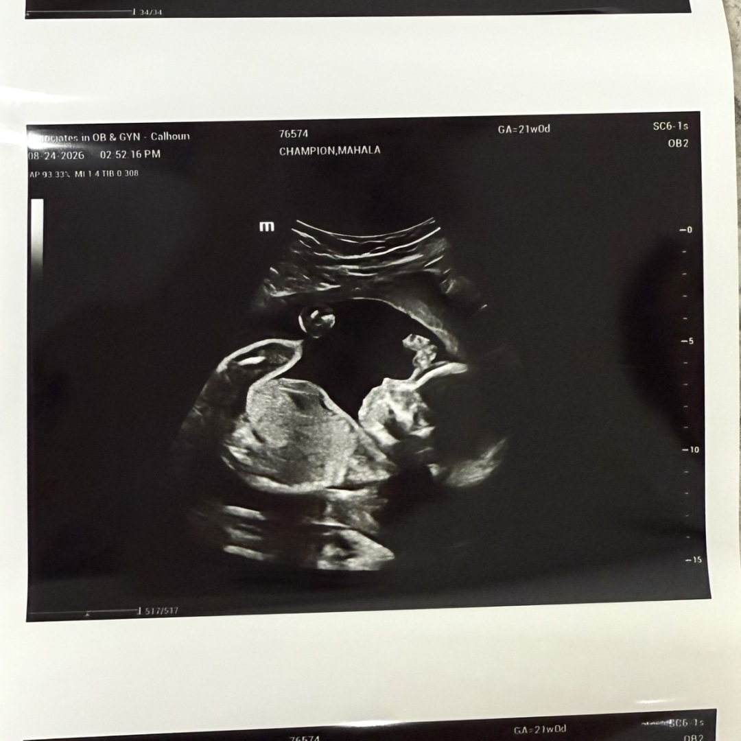 Photo shared by Mahala for their Babylist baby registry.