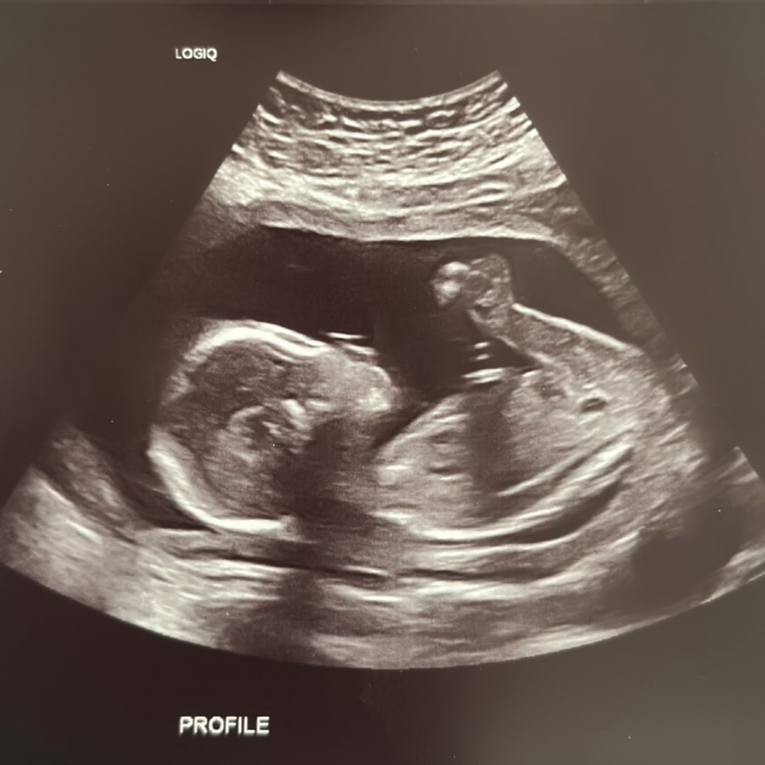 Photo shared by Kristi for their Babylist baby registry.