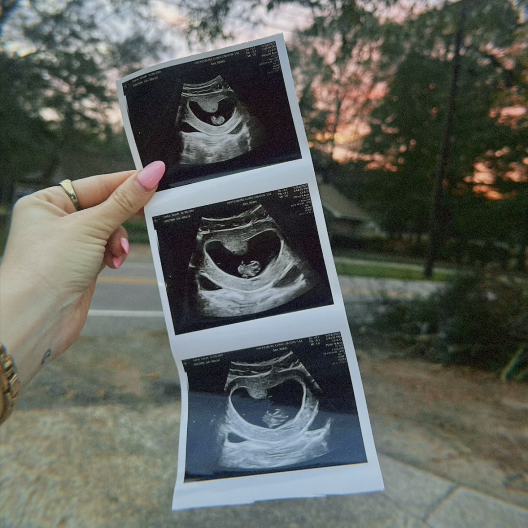 Photo shared by Sairah for their Babylist baby registry.