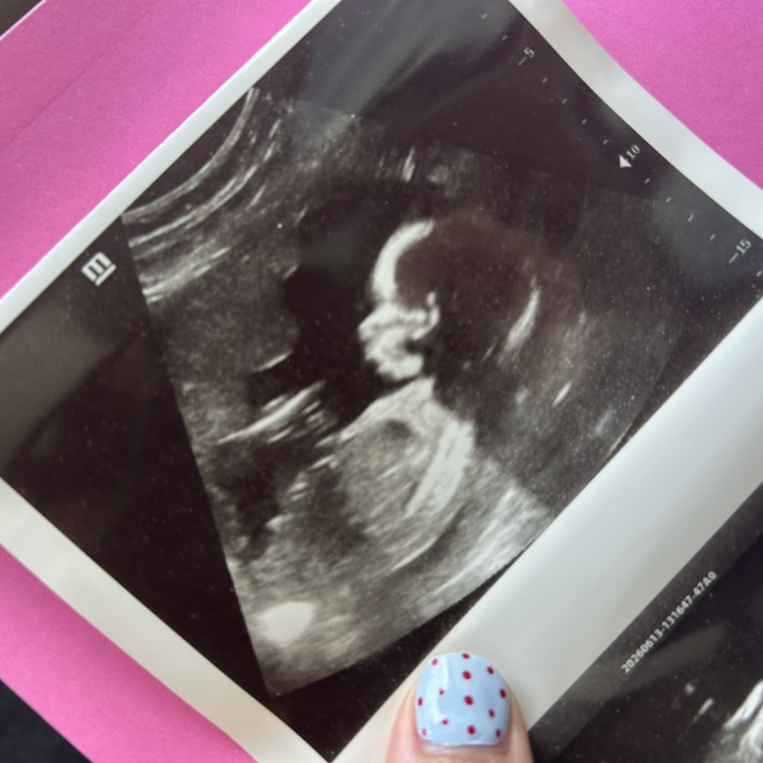 Photo shared by Rosalinda for their Babylist baby registry.