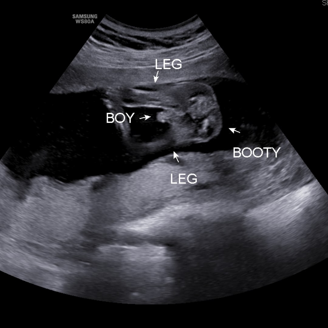 Photo shared by Adilya for their Babylist baby registry.