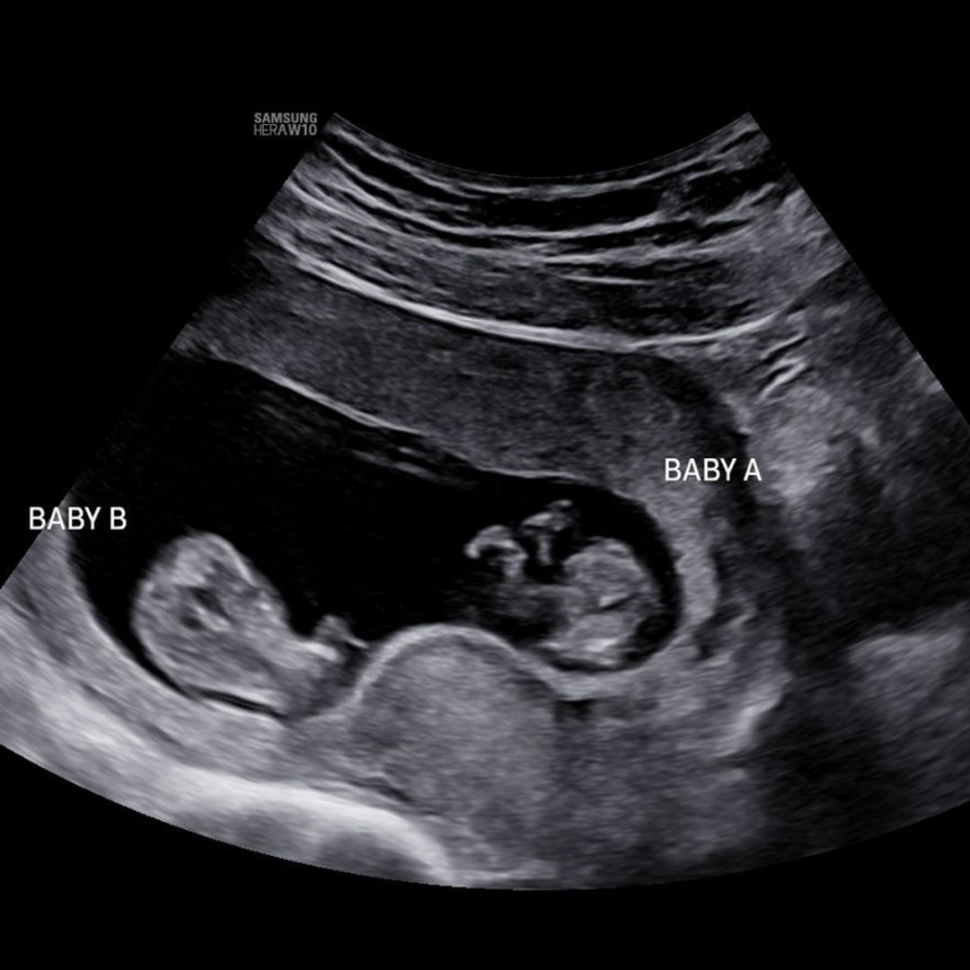 Photo shared by Gabrielle for their Babylist baby registry.