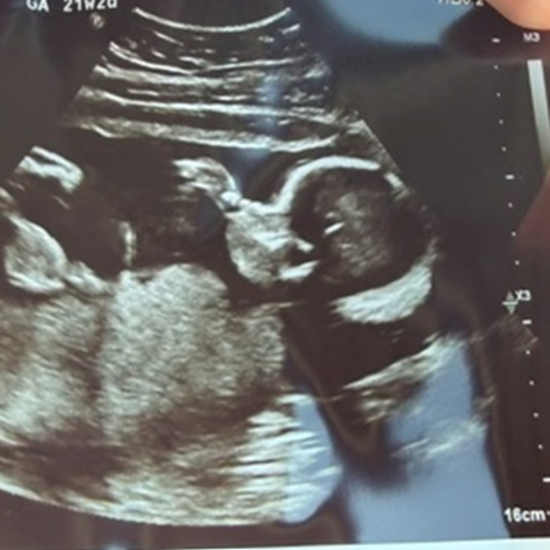 Photo shared by Madison for their Babylist baby registry.