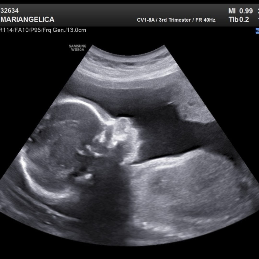 Photo shared by Mariangelica for their Babylist baby registry.
