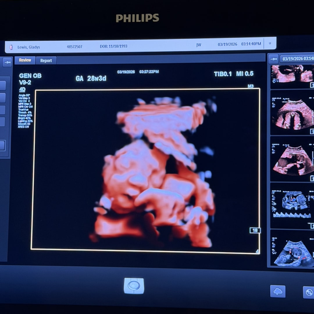 Photo shared by Gladys for their Babylist baby registry.