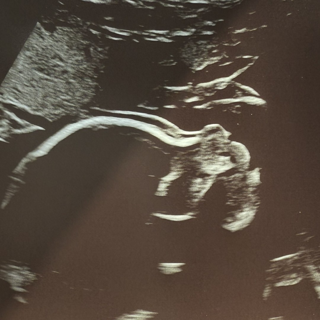 Photo shared by Corrine for their Babylist baby registry.