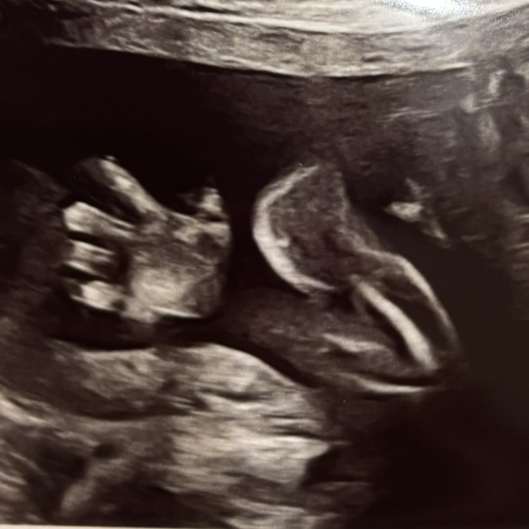 Photo shared by Madelyn for their Babylist baby registry.