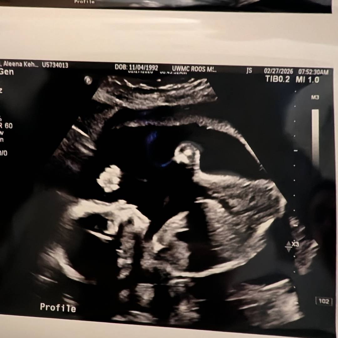 Photo shared by Aleena for their Babylist baby registry.