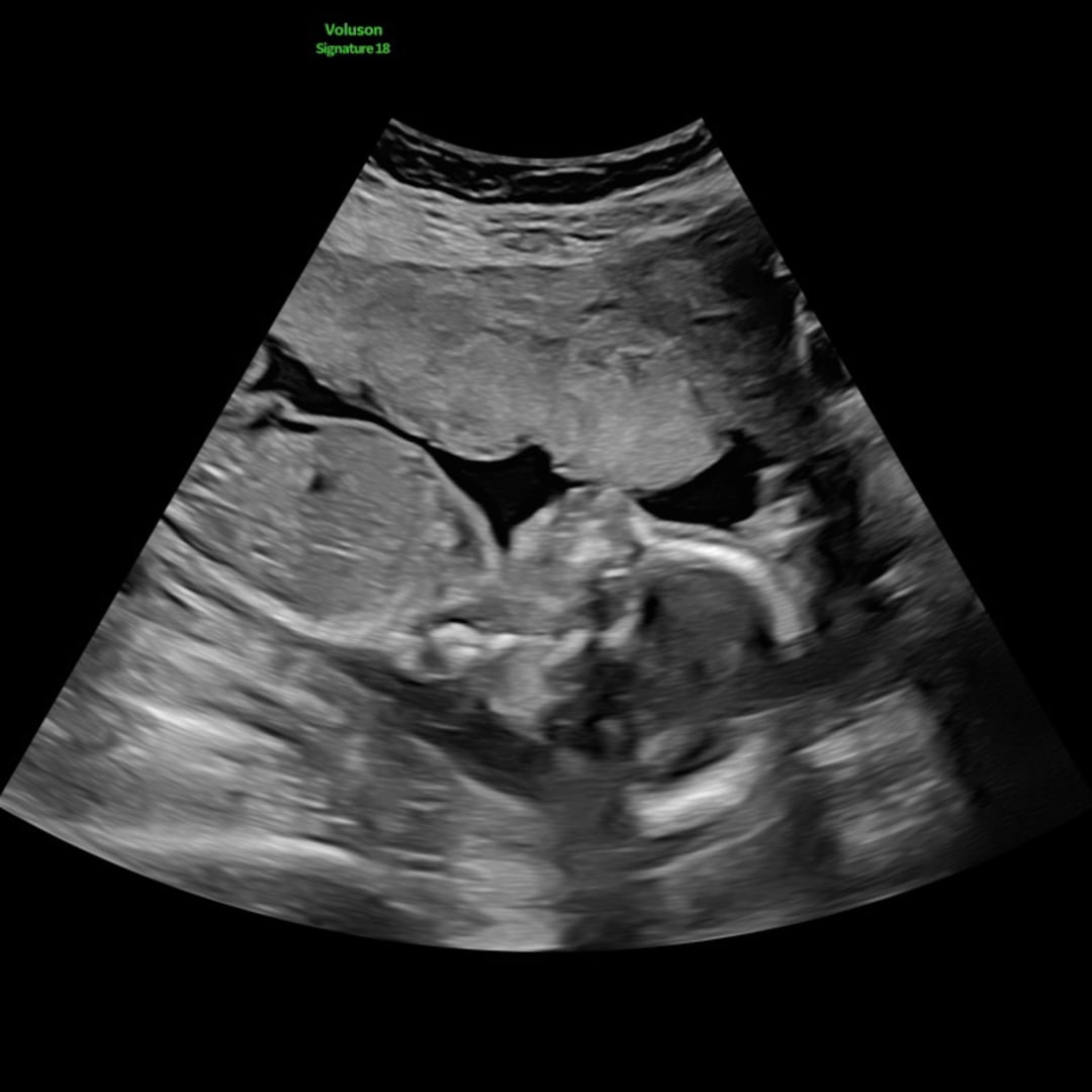 Photo shared by Lexie for their Babylist baby registry.