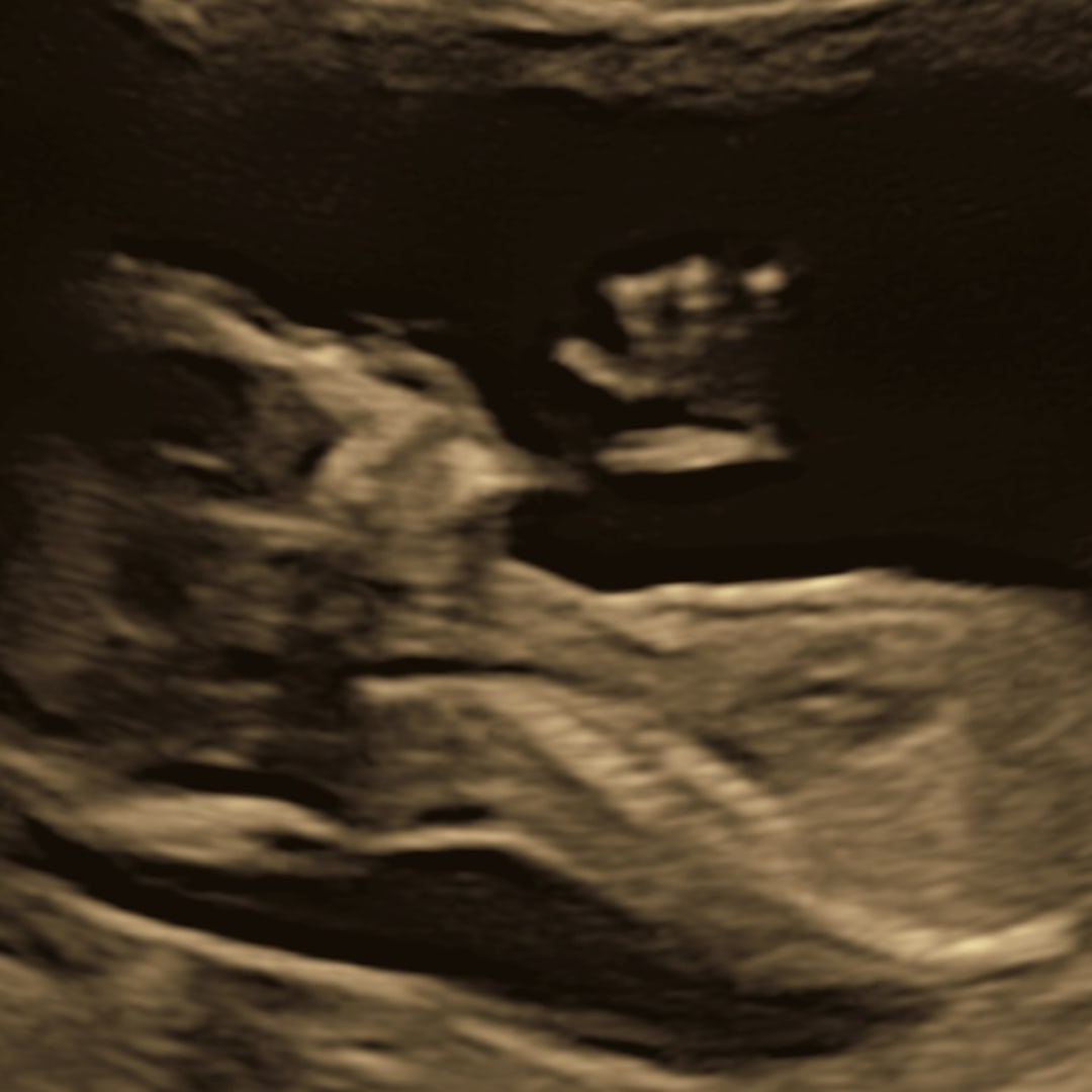 Photo shared by Katie for their Babylist baby registry.