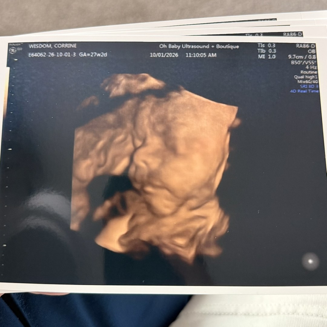 Photo shared by Corrine for their Babylist baby registry.