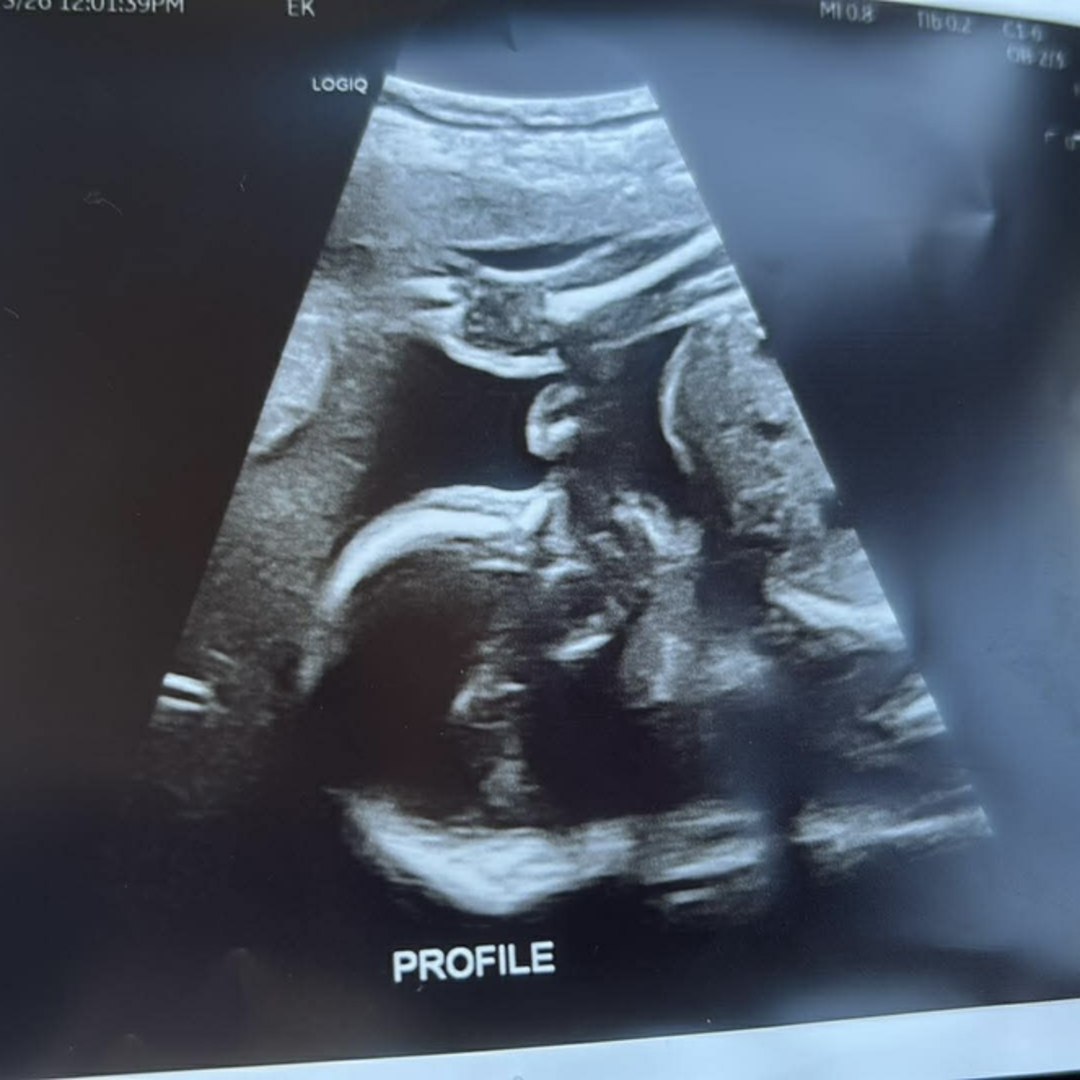 Photo shared by Megan for their Babylist baby registry.