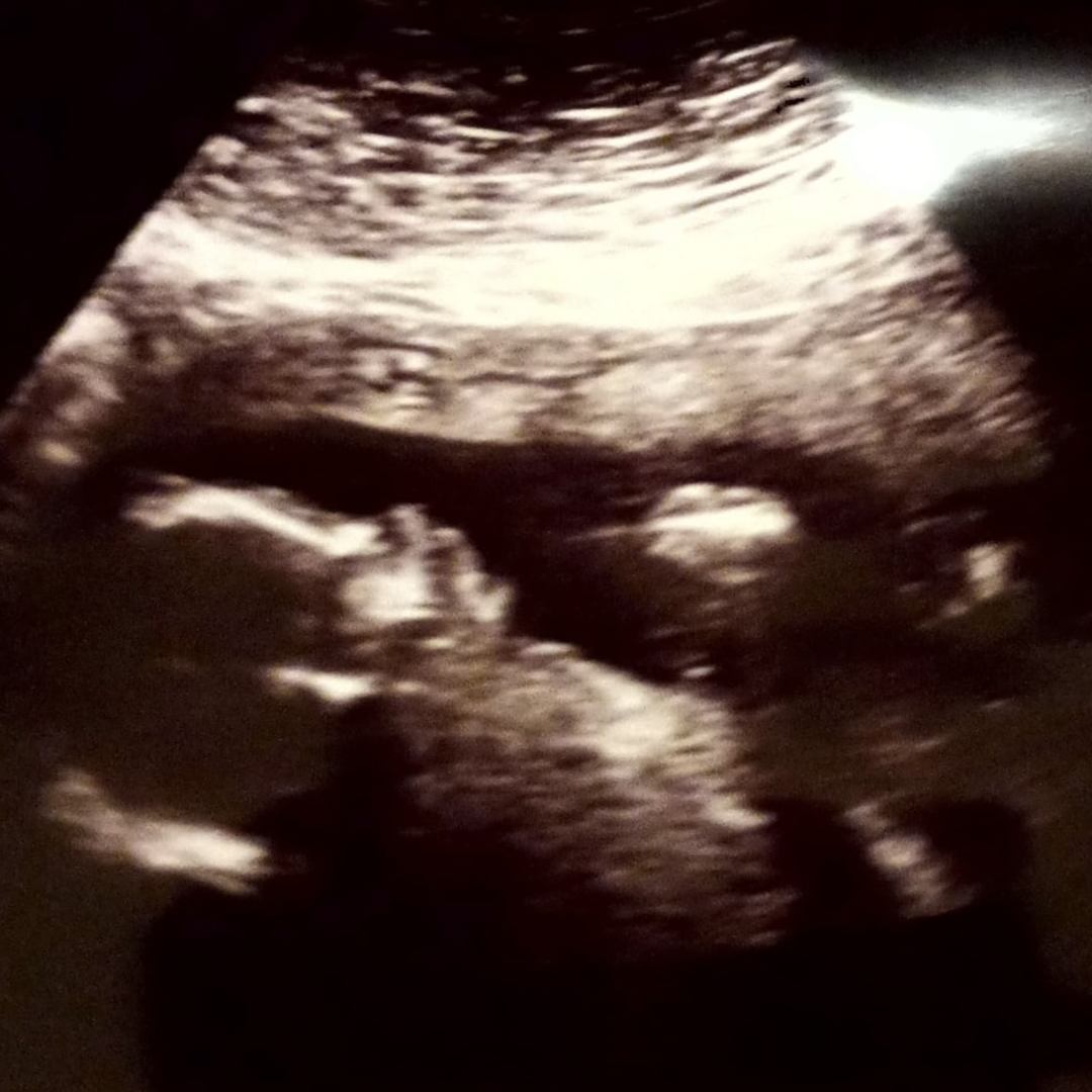 Photo shared by Jodi for their Babylist baby registry.