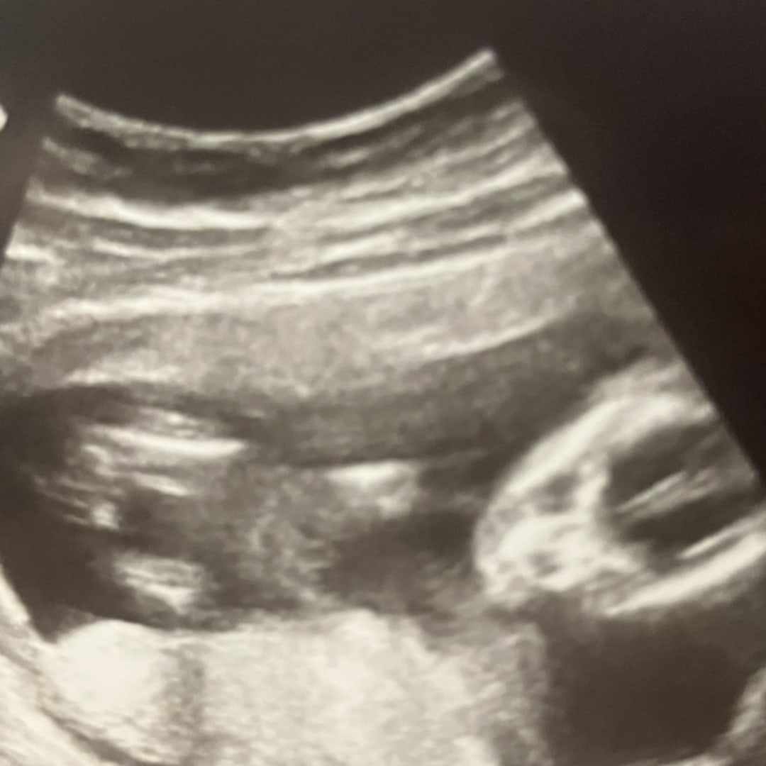 Photo shared by Becca (Rebecca) for their Babylist baby registry.