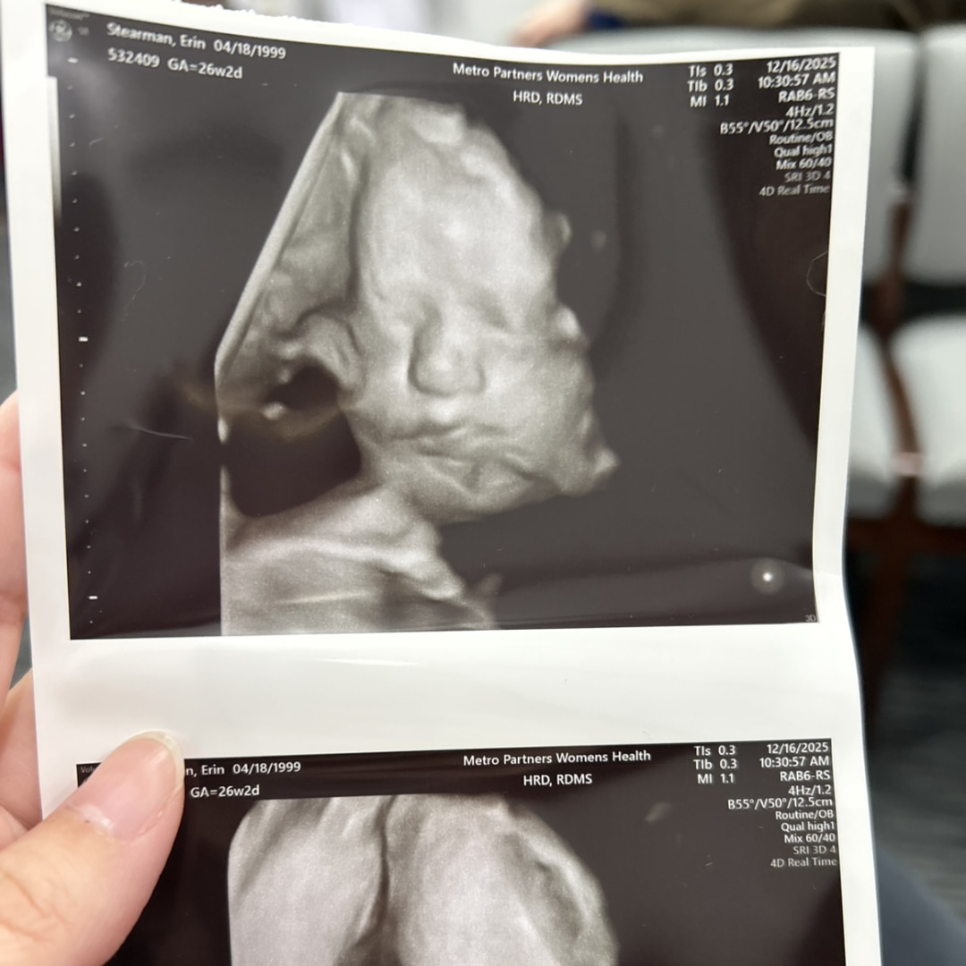 Photo shared by Erin for their Babylist baby registry.