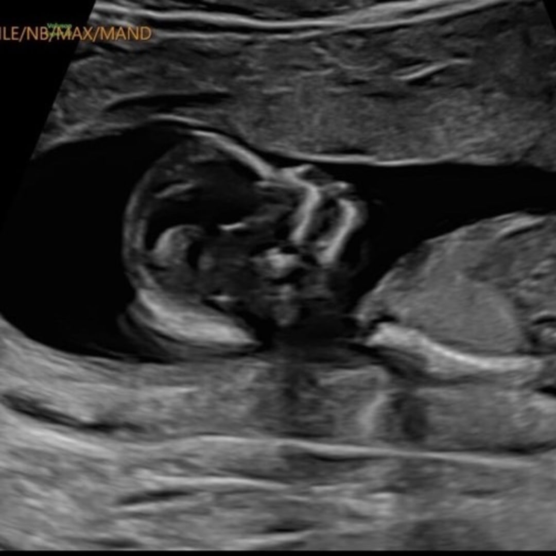 Photo shared by Cheyenne for their Babylist baby registry.