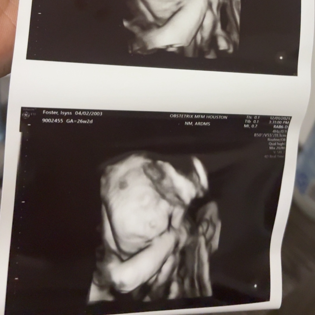 Photo shared by Isyss for their Babylist baby registry.