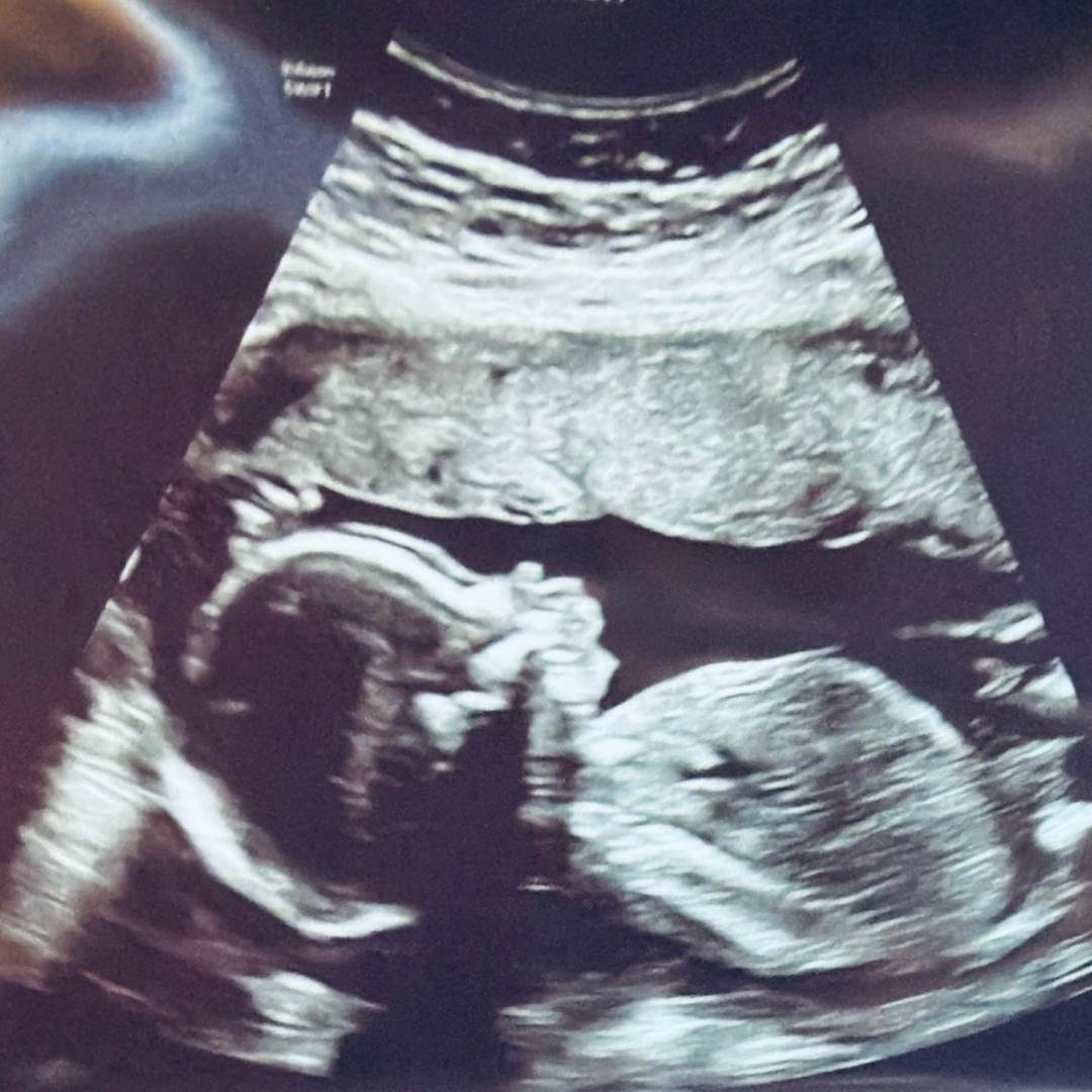 Photo shared by Maky for their Babylist baby registry.