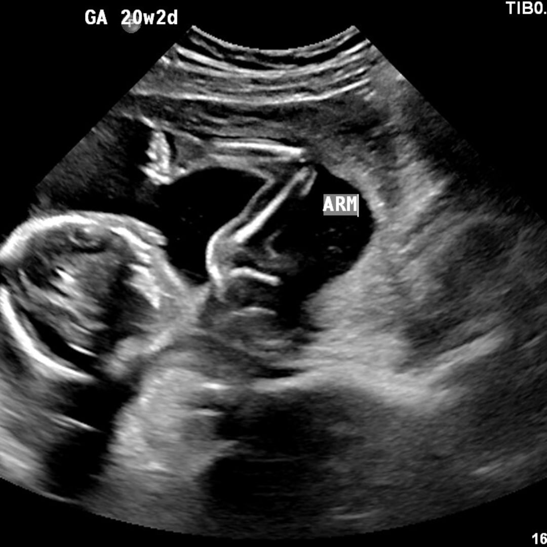 Photo shared by Sarah for their Babylist baby registry.