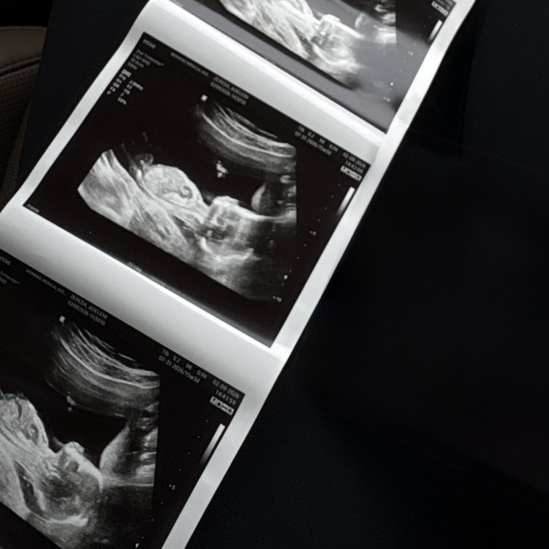 Photo shared by Adeleni for their Babylist baby registry.