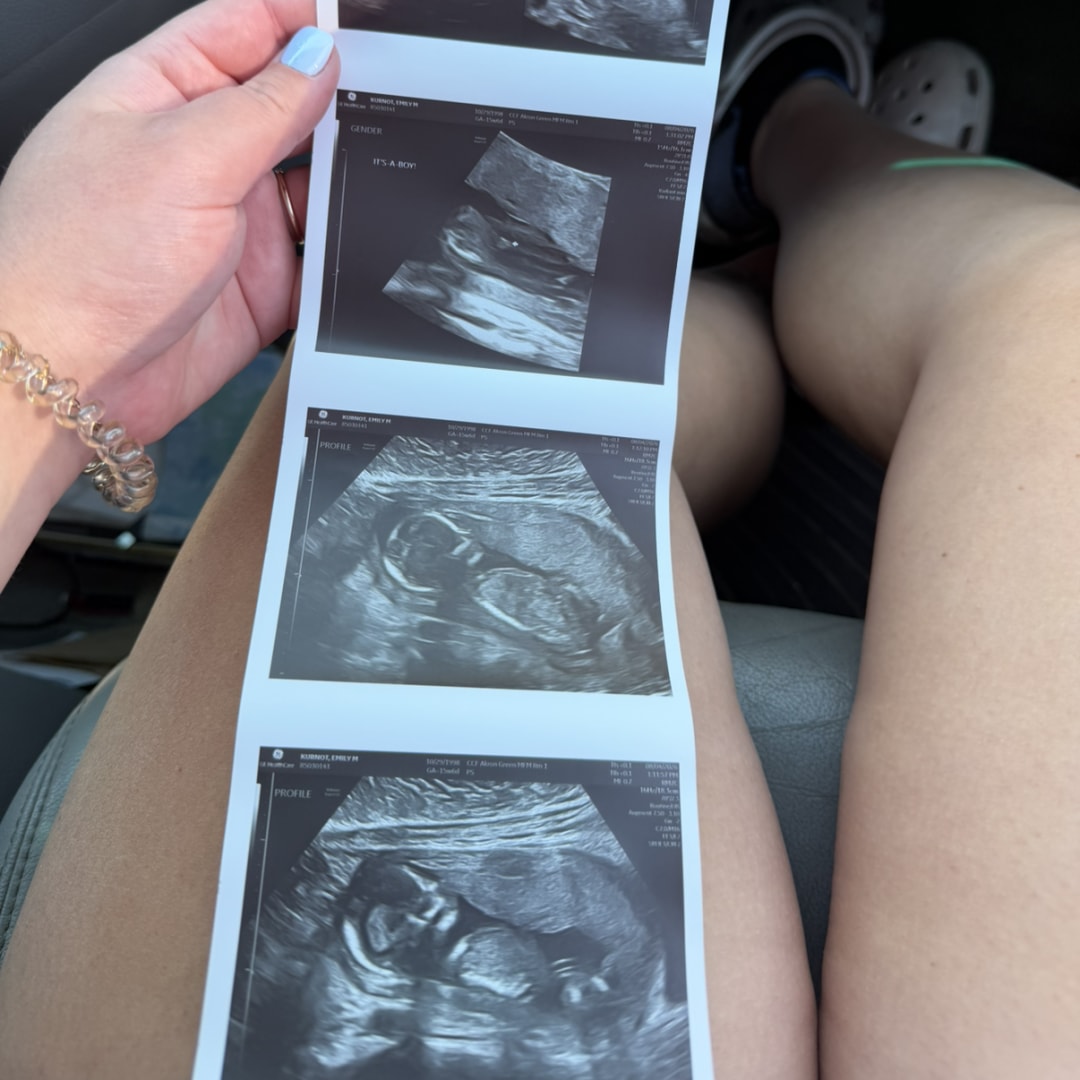 Photo shared by Emily for their Babylist baby registry.