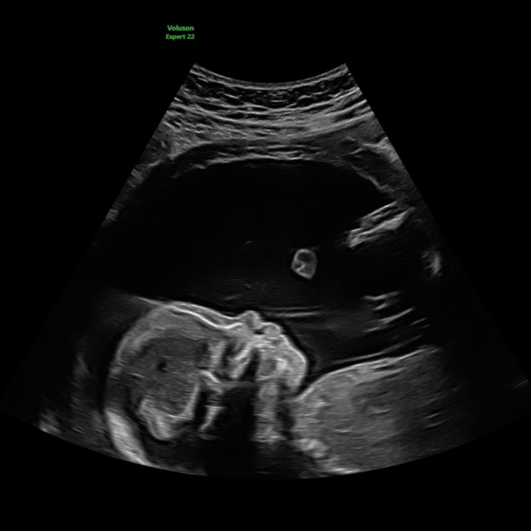 Photo shared by Michelle for their Babylist baby registry.