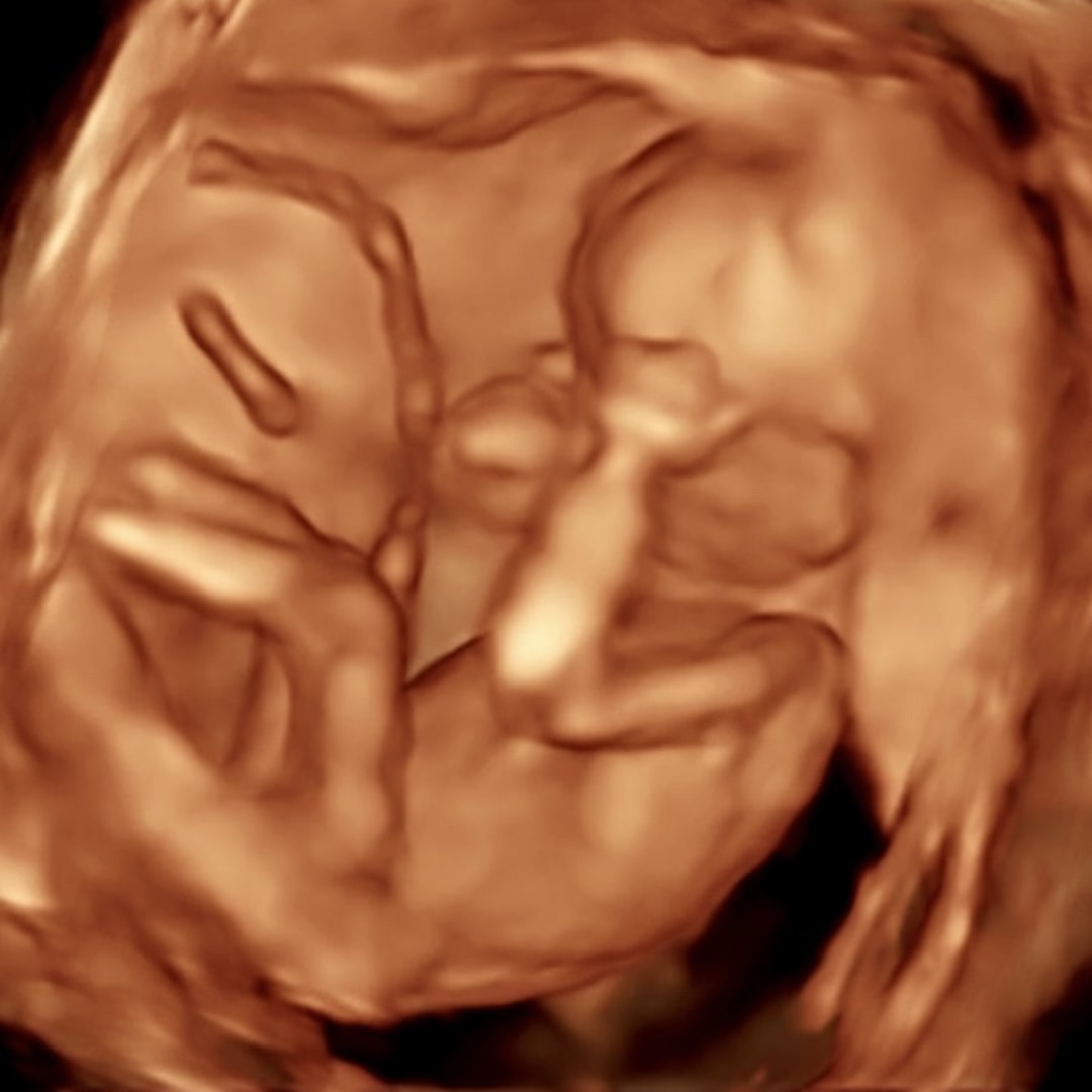 Photo shared by Paige for their Babylist baby registry.