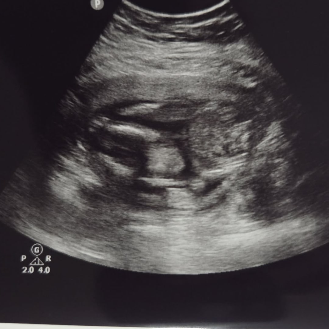 Photo shared by Ashleigh for their Babylist baby registry.