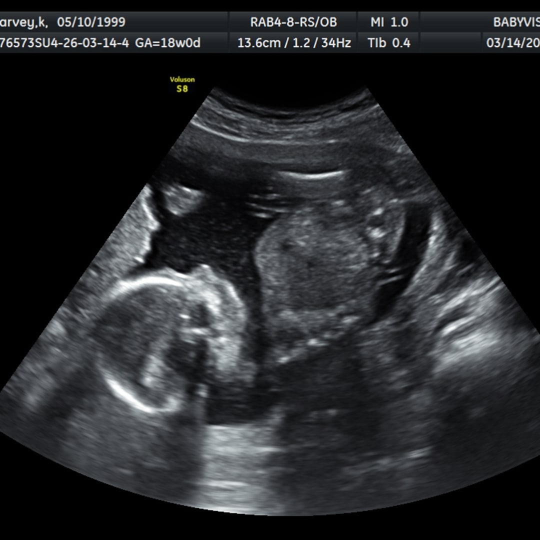 Photo shared by Kayla for their Babylist baby registry.