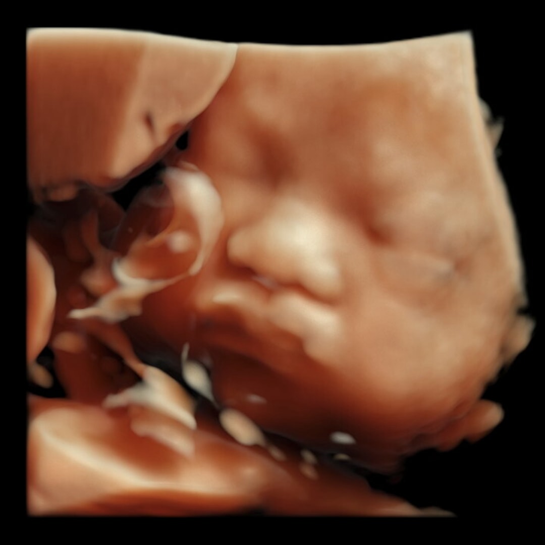 Photo shared by Kay for their Babylist baby registry.