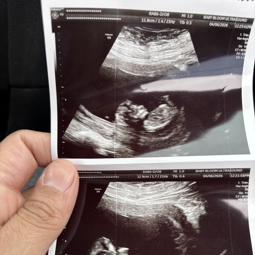 Photo shared by Sabrina for their Babylist baby registry.
