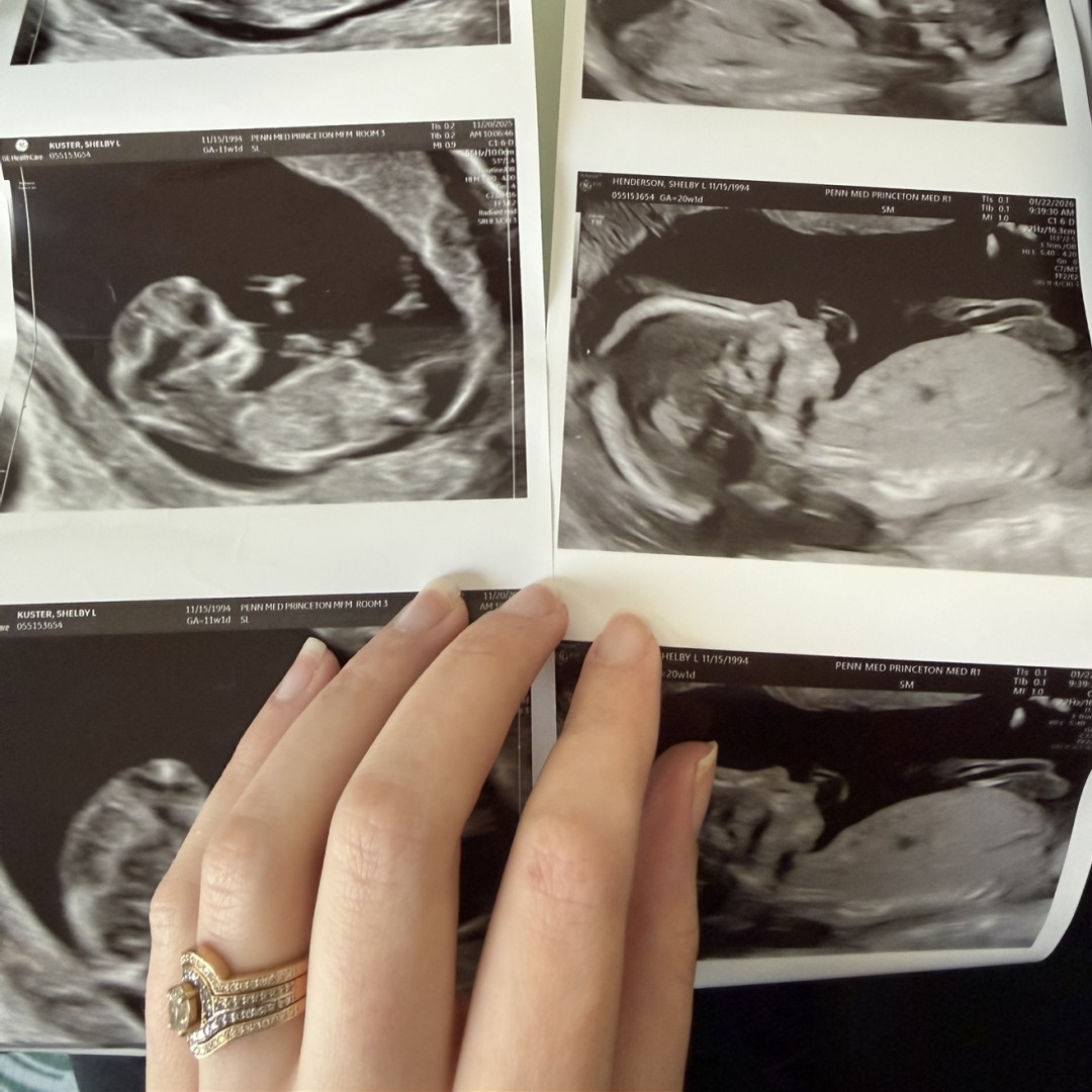 Photo shared by Shelby for their Babylist baby registry.