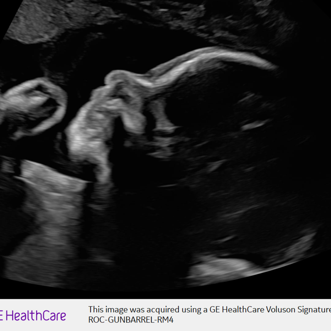 Photo shared by Celien for their Babylist baby registry.