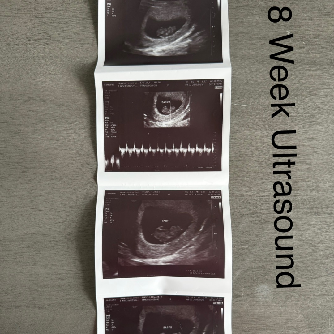 Photo shared by Elizabeth for their Babylist baby registry.