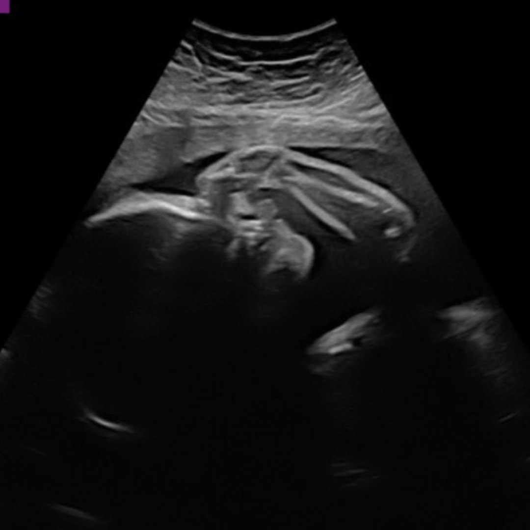 Photo shared by Jennifer for their Babylist baby registry.