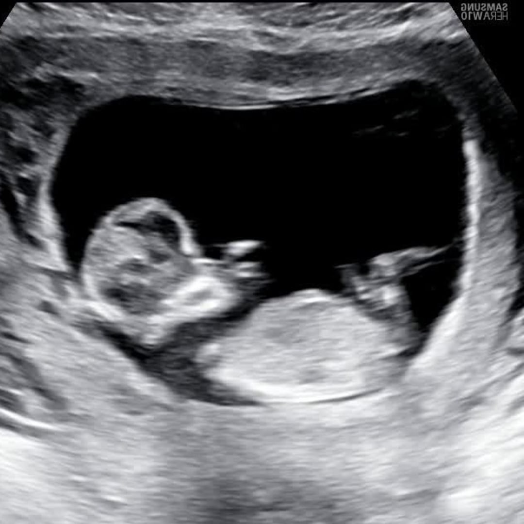 Photo shared by Chardea for their Babylist baby registry.