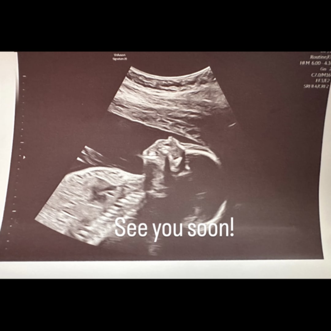 Photo shared by Angie for their Babylist baby registry.