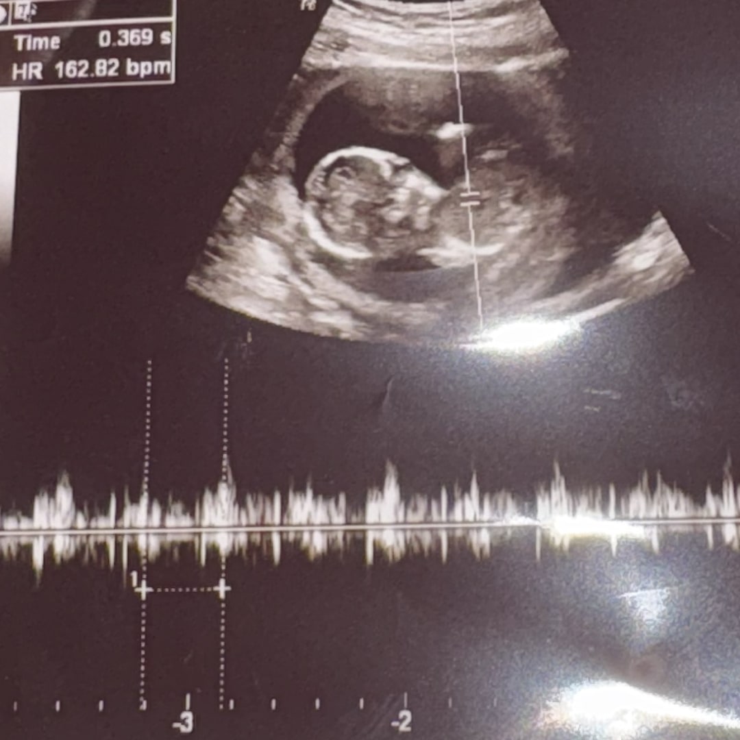 Photo shared by Sierra for their Babylist baby registry.