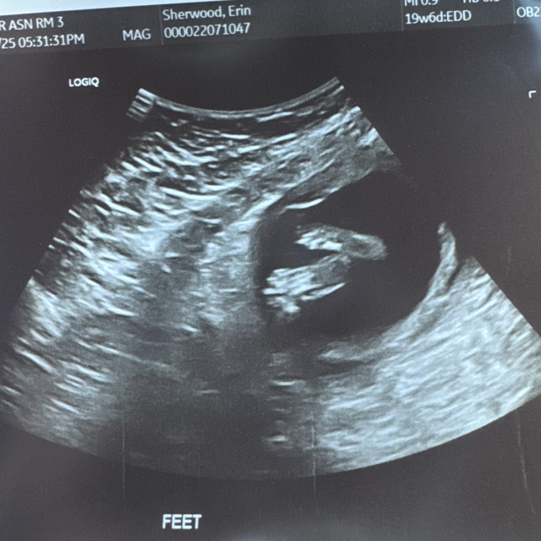 Photo shared by Erin for their Babylist baby registry.