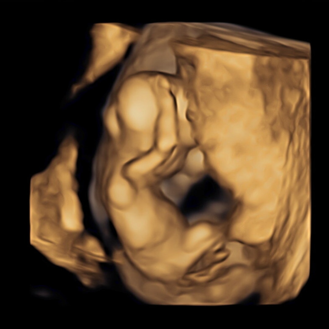 Photo shared by Sheyenne for their Babylist baby registry.