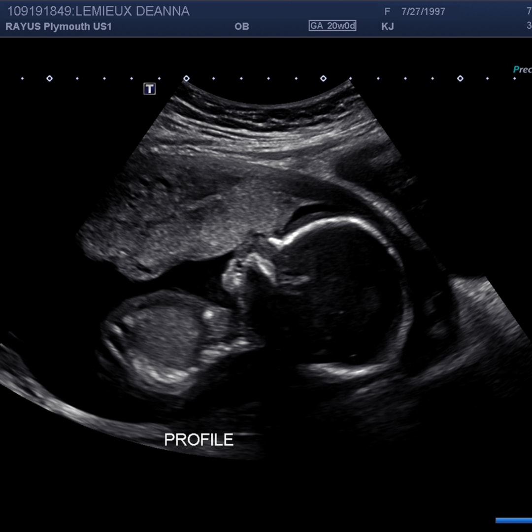 Photo shared by Deanna for their Babylist baby registry.
