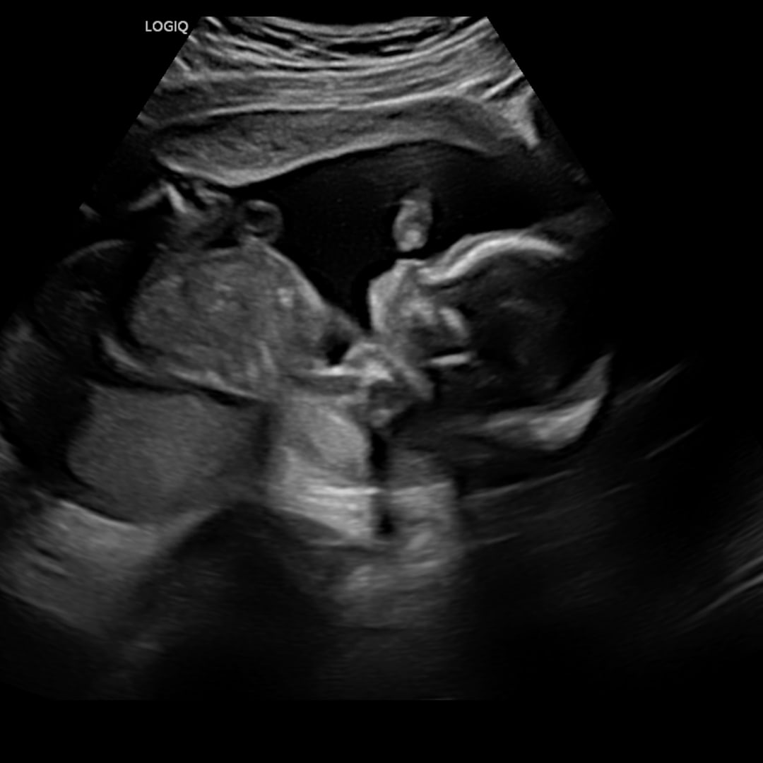 Photo shared by Janie for their Babylist baby registry.
