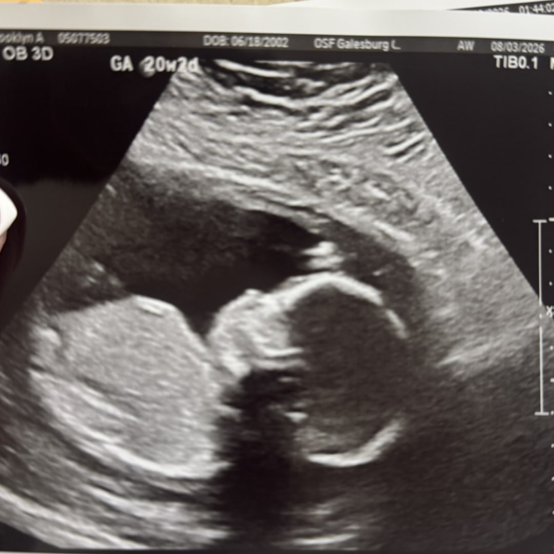 Photo shared by Brooklyn for their Babylist baby registry.