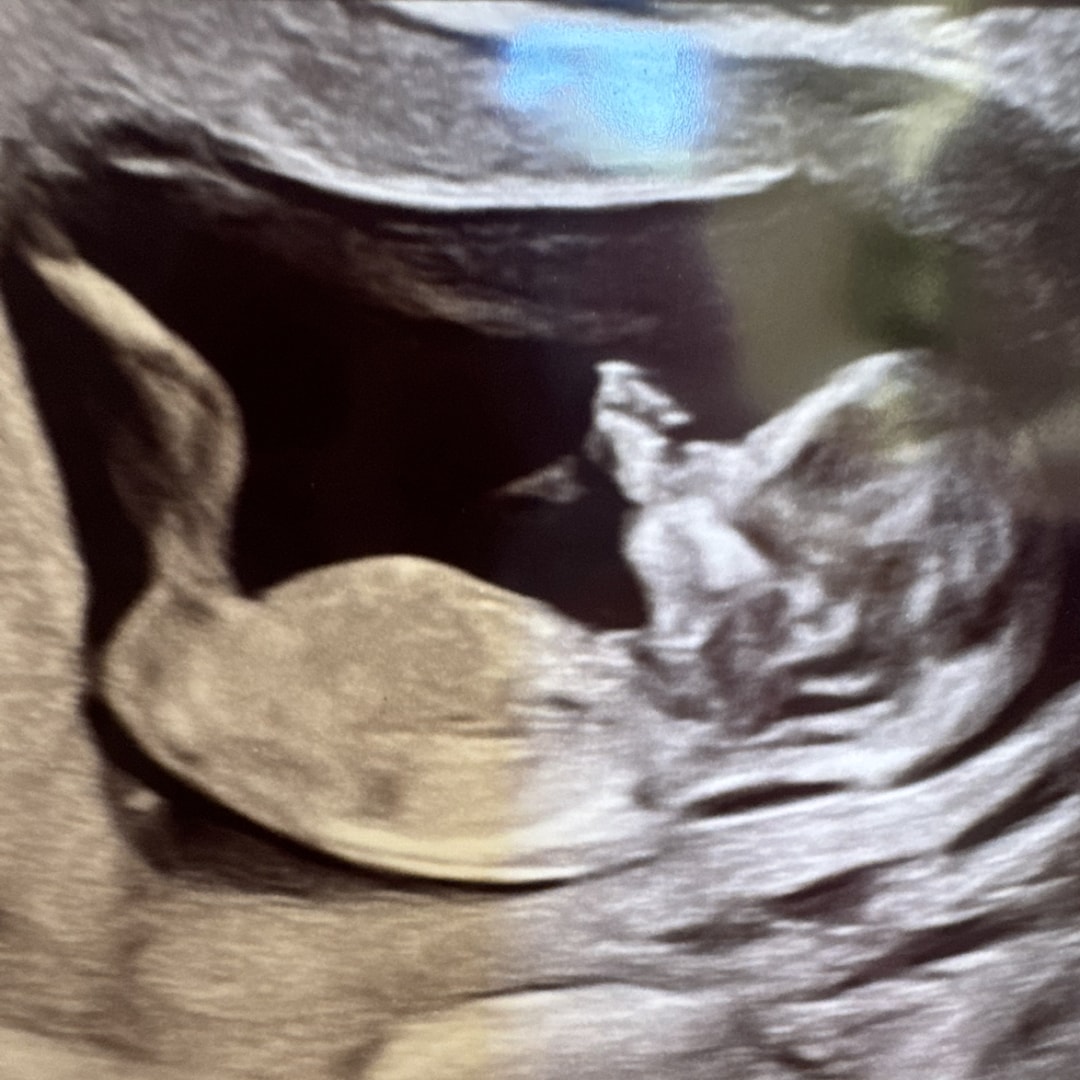 Photo shared by Molly for their Babylist baby registry.